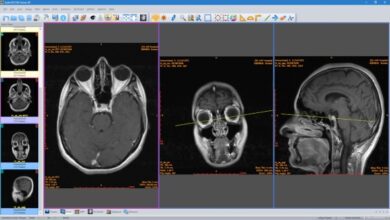 Sante DICOM Viewer 3D Pro 4.9.4