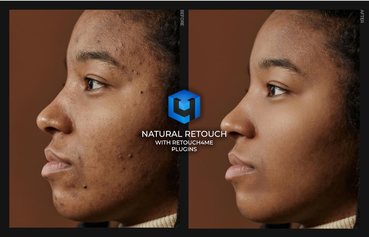 Retouch4me Skin Tone 1.019